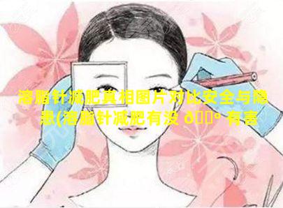 溶脂针减肥真相图片对比安全与隐患(溶脂针减肥有没 🐺 有害 💐 处对身体)